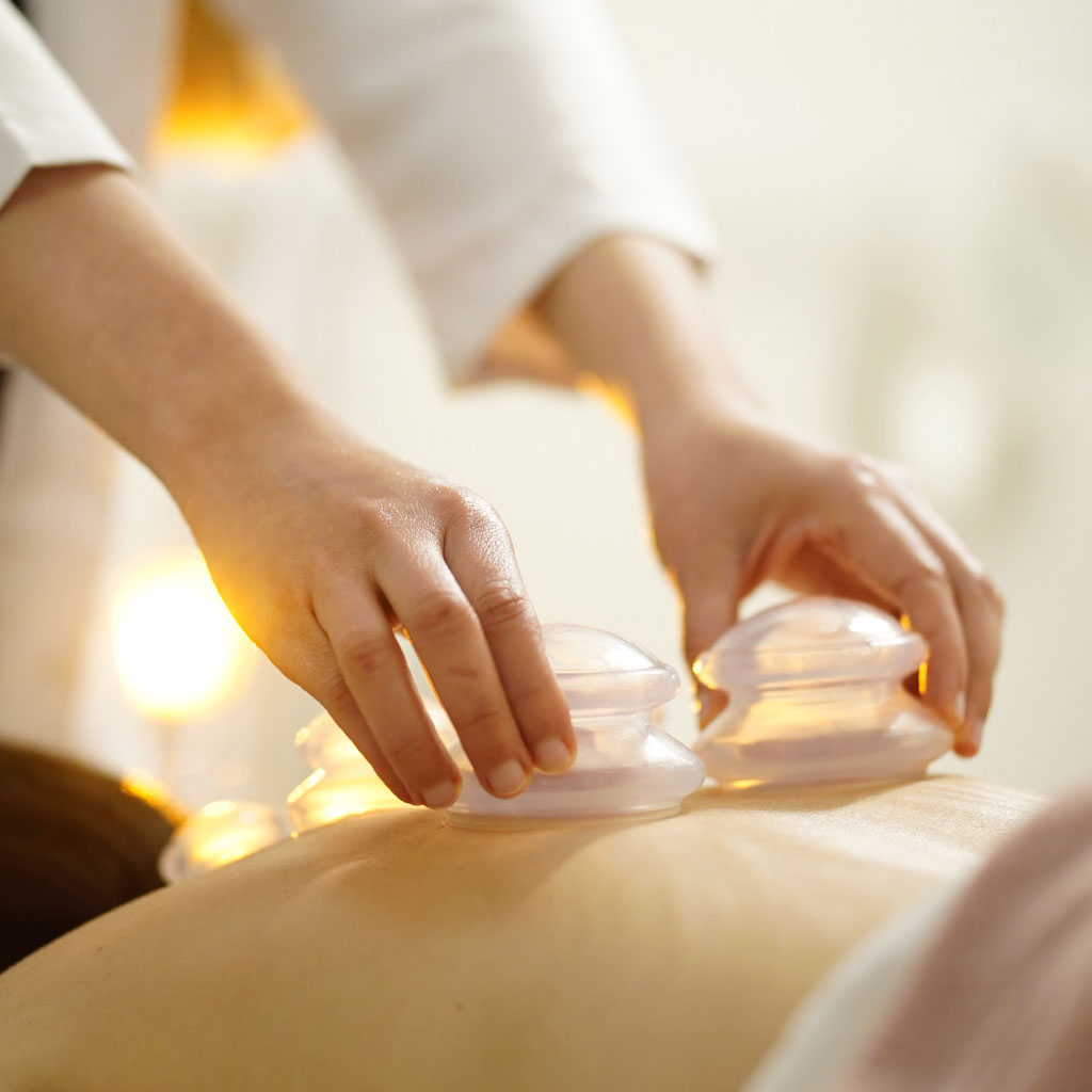 Cupping therapy treatment